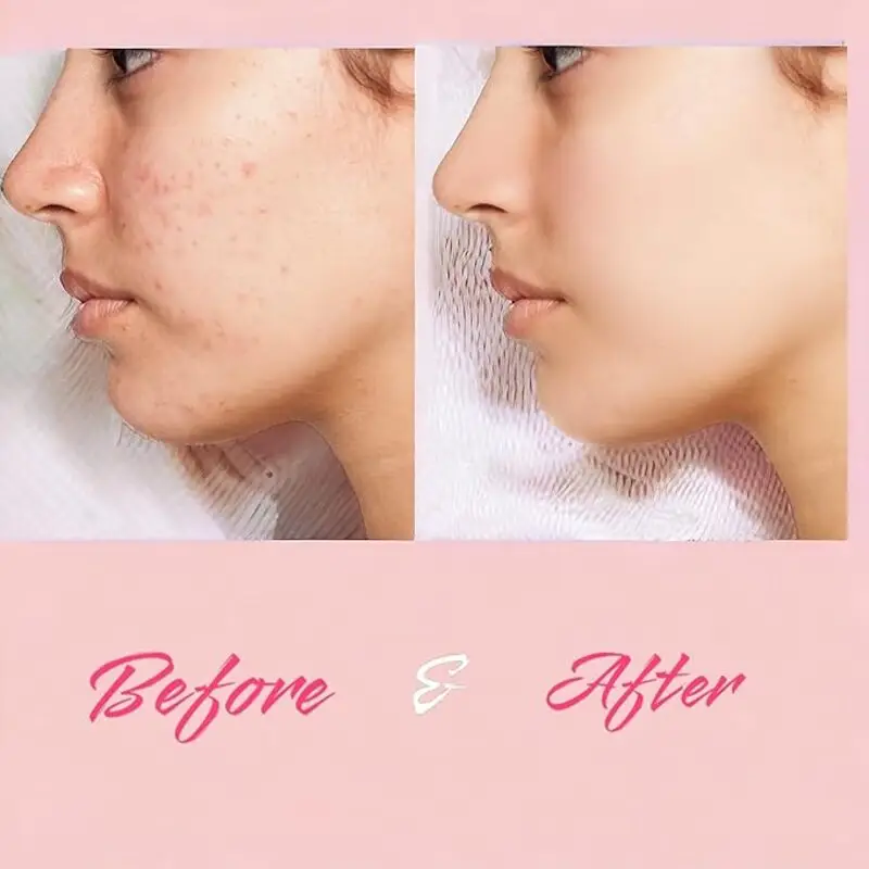 برس برقی پاکسازی صورت آدلا با 3 سری تعویضی مختلف، 2 سرعت تنظیم، ضد آب و قابل شارژ  زرافه